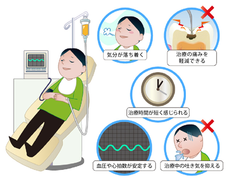 静脈鎮静法